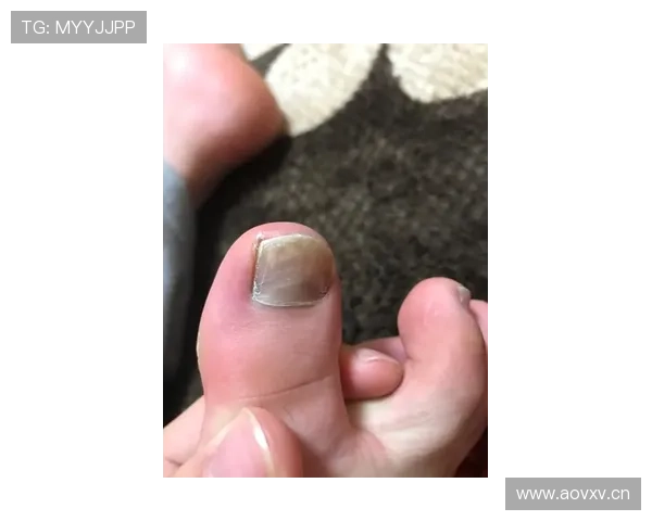 邹敬园赛后脱了篮球鞋，脚趾甲完全吓我一跳，感觉他都不用剪了？